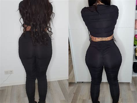 Brazilian Butt Lift .